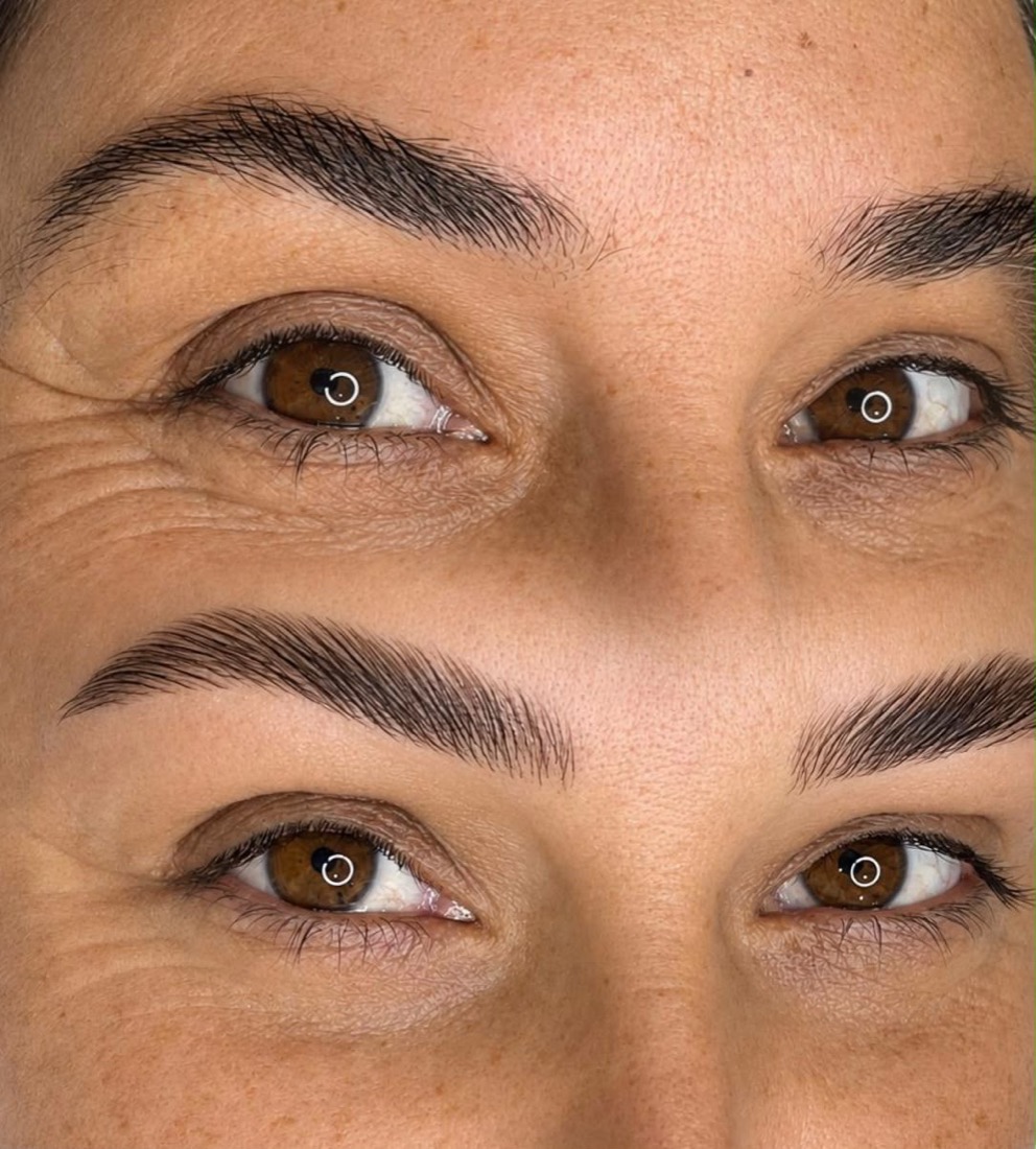 Antes e depois de Brow lamination
