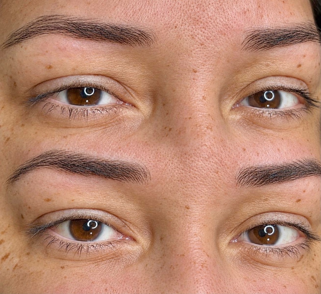 Antes e depois de Fio a fio
